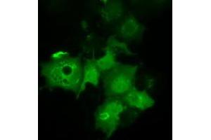 Anti-C21orf59 mouse monoclonal antibody (ABIN2452868) immunofluorescent staining of COS7 cells transiently transfected by pCMV6-ENTRY C21orf59 (RC200169). (C21orf59 antibody)
