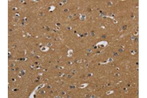 The image on the left is immunohistochemistry of paraffin-embedded Human brain tissue using ABIN7130524(PAEP Antibody) at dilution 1/60, on the right is treated with fusion protein.