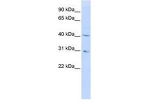 Image no. 1 for anti-Dihydroorotate Dehydrogenase (DHODH) (AA 180-229) antibody (ABIN6740743) (DHODH antibody  (AA 180-229))