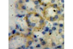 IHC-P analysis of Kidney tissue, with DAB staining. (ADAMTS1 antibody  (AA 560-911))