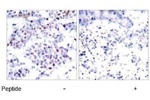 Image no. 1 for anti-Signal Transducer and Activator of Transcription 6, Interleukin-4 Induced (STAT6) (Thr645) antibody (ABIN197186) (STAT6 antibody  (Thr645))