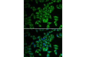 Immunofluorescence analysis of A549 cells using FXN antibody. (Frataxin antibody)