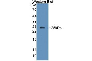 Western blot analysis of the recombinant protein. (XPO5 antibody  (AA 2-180))