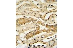 NDUF3 antibody (N-term) (ABIN654942 and ABIN2844583) immunohistochemistry analysis in formalin fixed and paraffin embedded human lung tissue followed by peroxidase conjugation of the secondary antibody and DAB staining. (NDUFAF3 antibody  (N-Term))