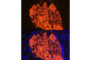 Immunofluorescence analysis of Mouse placenta using HB antibody (ABIN6129603, ABIN6141637, ABIN6141638 and ABIN6224486) at dilution of 1:100 (40x lens). (HBa2 antibody  (AA 1-142))