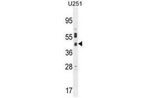 CB018 Antibody (C-term) western blot analysis in U251 cell line lysates (35µg/lane). (SLC35F6 antibody  (C-Term))