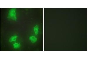 Immunofluorescence analysis of HeLa cells, using CDK5R1 antibody. (CDK5R1 antibody  (N-Term))