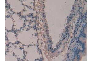IHC-P analysis of Rat Lung Tissue, with DAB staining. (Periostin antibody  (AA 659-810))