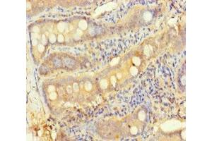 Immunohistochemistry of paraffin-embedded human small intestine tissue using ABIN7166174 at dilution of 1:100 (TESPA1 antibody  (AA 251-521))