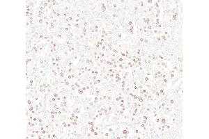 Immunohistochemistry (IHC) image for anti-Insulinoma-Associated 1 (INSM1) (AA 75-125) antibody (ABIN7795670) (Recombinant INSM1 antibody  (AA 75-125))
