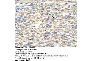 Immunohistochemistry (IHC) image for anti-CDKN2A Interacting Protein (CDKN2AIP) (C-Term) antibody (ABIN2779115) (CDKN2AIP antibody  (C-Term))