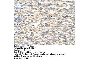 Immunohistochemistry (IHC) image for anti-CDKN2A Interacting Protein (CDKN2AIP) (C-Term) antibody (ABIN2779115)