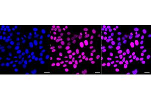 Immunocytochemical staining of HepG2 cells with Chromodomain helicase DNA binding protein 3 antibody (ABIN7798069), 1:1,000). (Recombinant CHD3 antibody)