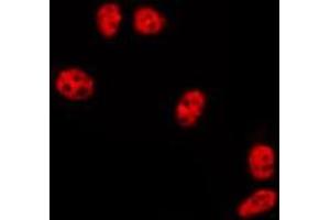 ABIN6275732 staining HepG2 by IF/ICC. (ZNF695 antibody  (C-Term))