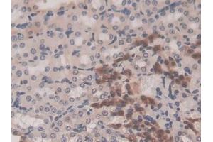 Detection of GSTM1 in Mouse Kidney Tissue using Polyclonal Antibody to Glutathione S Transferase Mu 1 (GSTM1) (GSTM1 antibody  (AA 1-218))