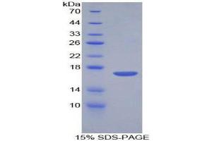 SDS-PAGE (SDS) image for Corin, Serine Peptidase (CORIN) (AA 521-637) protein (His tag) (ABIN2124505) (Corin Protein (AA 521-637) (His tag))