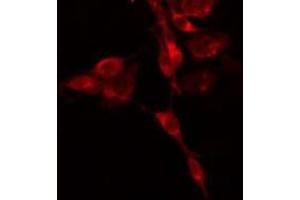 ABIN6275175 staining  HepG2 cells by IF/ICC. (GNAI3 antibody  (N-Term))