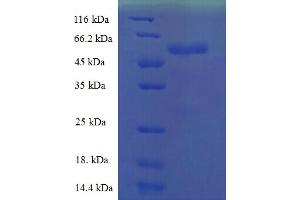 SDS-PAGE (SDS) image for Trihelix Transcription Factor GT-1 (AA 1-406), (full length) protein (His tag) (ABIN5711757) (Trihelix Transcription Factor GT-1 (AA 1-406), (full length) protein (His tag))