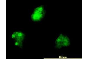 Image no. 5 for anti-KH Domain Containing, RNA Binding, Signal Transduction Associated 1 (KHDRBS1) (AA 176-275) antibody (ABIN599148) (KHDRBS1 antibody  (AA 176-275))