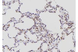 ABIN6276858 at 1/100 staining Rat lung tissue by IHC-P. (POLR2E antibody  (Internal Region))