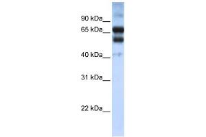 WB Suggested Anti-RARG Antibody Titration:  0. (Retinoic Acid Receptor gamma antibody  (N-Term))