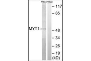 Western blot analysis of extracts from HeLa cells, using MYT1 Antibody . (PKMYT1 antibody  (Internal Region))