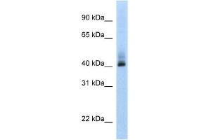 Human MCF-7; WB Suggested Anti-ANKRD42 Antibody Titration: 0. (ANKRD42 antibody  (N-Term))