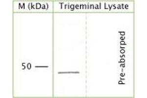 WB on rat trigeminal lysate (10% gel, 1:29. (NGFR antibody  (Extracellular Domain))