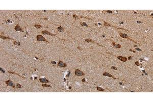 Immunohistochemistry of paraffin-embedded Human brain tissue using PLXNB1 Polyclonal Antibody at dilution 1:40 (PLXNB1 antibody)