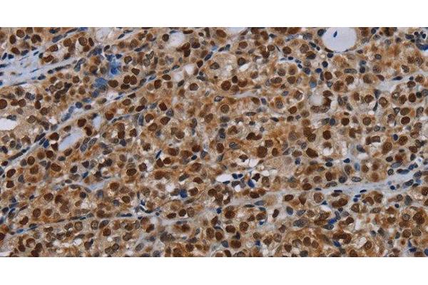DCAF6 antibody