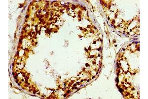 Immunohistochemistry of paraffin-embedded human testis tissue using ABIN7148935 at dilution of 1:100 (GAK antibody  (AA 939-1086))