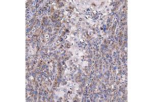 IHC analysis of TTC7B using anti-TTC7B antibody (ABIN7601050). (TTC7B antibody  (AA 275-730))