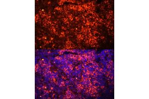 Immunofluorescence (IF) image for anti-Toll-Like Receptor 8 (TLR8) (AA 849-1041) antibody (ABIN3022015)