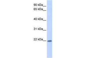 Image no. 1 for anti-Zinc Finger Protein 534 (ZNF534) (AA 101-150) antibody (ABIN6744478) (ZNF534 antibody  (AA 101-150))