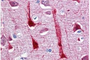 Human Brain, cortex: Formalin-Fixed, Paraffin-Embedded (FFPE) (CRYM antibody  (AA 215-315))