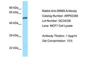 Image no. 1 for anti-Src-Related Kinase Lacking C-Terminal Regulatory Tyrosine and N-Terminal Myristylation Sites (SRMS) (C-Term) antibody (ABIN6749978) (SRMS antibody  (C-Term))