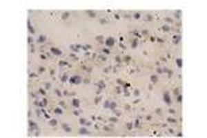 Image no. 1 for anti-Interleukin 18 (IL18) antibody (ABIN791564) (IL-18 antibody)