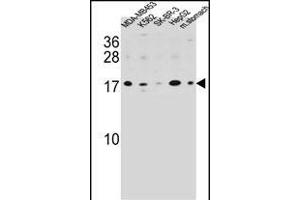 S100Z Antibody (N-term) (ABIN654583 and ABIN2844285) western blot analysis in MDA-M,K562,SK-BR-3,HepG2 cell line and mouse stomach tissue lysates (35 μg/lane).
