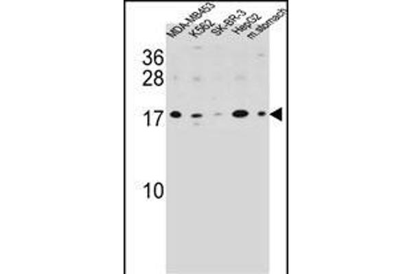 S100Z anticorps  (N-Term)