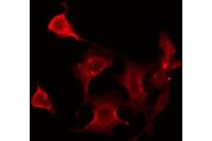 ABIN6275946 staining HeLa by IF/ICC. (FZD2 antibody  (Internal Region))
