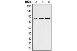 Western blot analysis of RAP1GAP expression in Jurkat (A), HeLa (B), mouse brain (C) whole cell lysates.