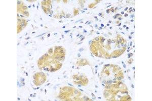Immunohistochemistry of paraffin-embedded Human stomach using UCHL3 Polyclonal Antibody at dilution of 1:100 (40x lens). (UCHL3 antibody)