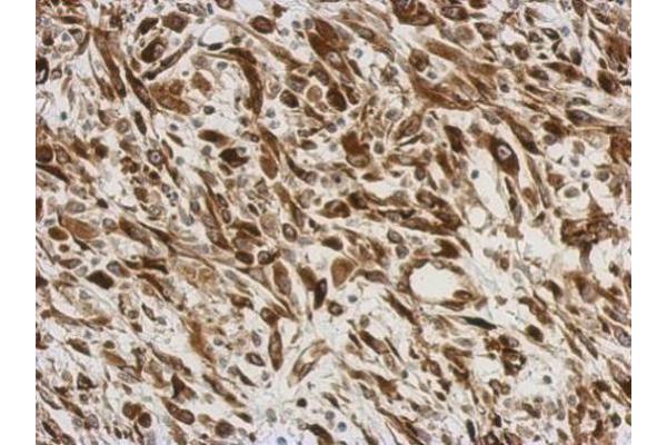 AGR3 antibody  (Center)