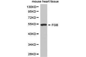 Western Blotting (WB) image for anti-Fibrinogen beta Chain (FGB) antibody (ABIN1872679) (Fibrinogen beta Chain antibody)