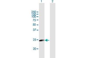Western Blot analysis of MYLC2PL expression in transfected 293T cell line by MYLC2PL MaxPab polyclonal antibody. (MYL10 antibody  (AA 1-226))