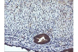 Image no. 4 for anti-Mitogen-Activated Protein Kinase Kinase 1 (MAP2K1) antibody (ABIN1499394) (MEK1 antibody)