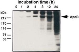 Western Blot analysis of MDA-LDL adduct formation. (Malondialdehyde antibody)