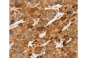 Immunohistochemistry (IHC) image for anti-Lymphotoxin beta (TNF Superfamily, Member 3) (LTB) antibody (ABIN5547159) (LTB antibody)