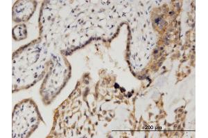 Immunoperoxidase of monoclonal antibody to CAMK1D on formalin-fixed paraffin-embedded human placenta. (CAMK1D antibody  (AA 1-95))