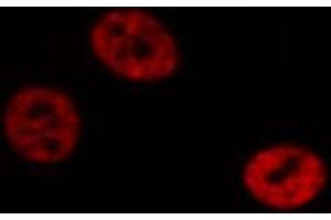 ABIN6272422 staining Hela by IF/ICC. (RTCD1 antibody  (C-Term))